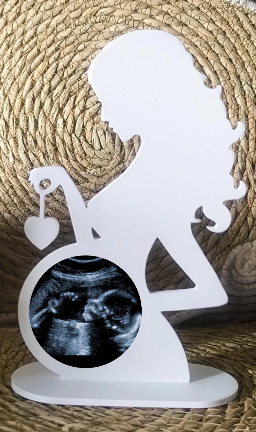 Ram za Slike Ultrazvuka Vaše Bebe  - Ramovi za slike, slika 4